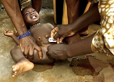 www.URBORN.de - grausame Genitalverstümmelung in Afrika - noch heute praktiziert